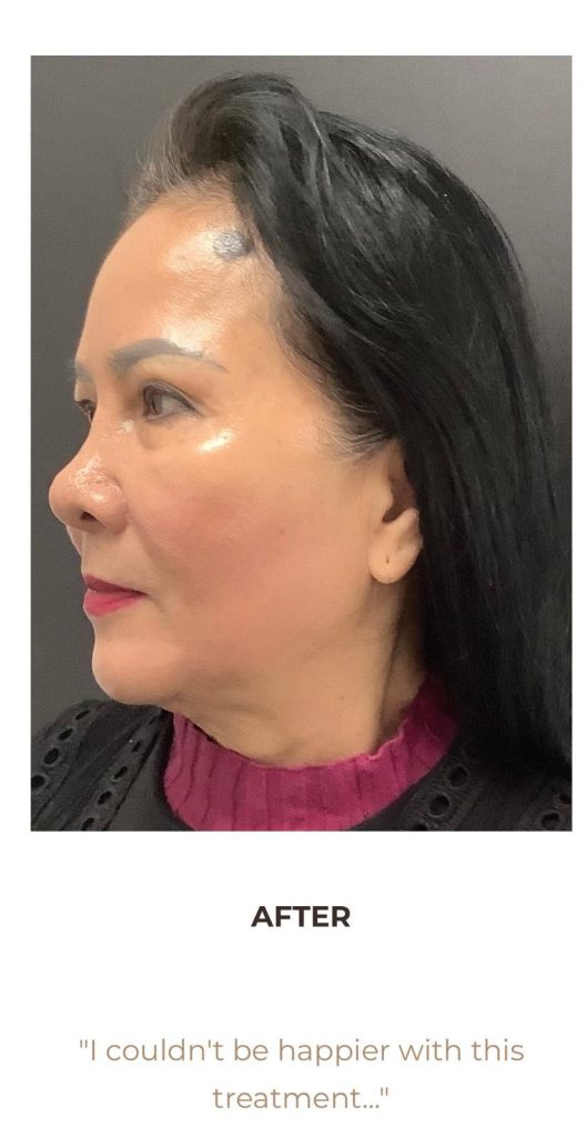 0d4a11b1 4a19 4fc4 96a6 1e99985984cd