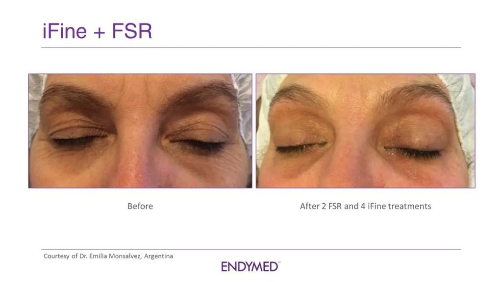 2379779e 8dd2 465f badb 4586ebb69521