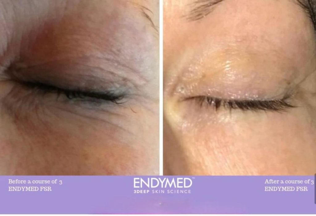 93a135cc 913e 4abe 9ae2 cfc7a63f29fe