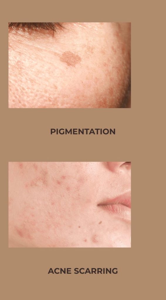 9442df01 15f0 476f 96ad 869683f2e49b