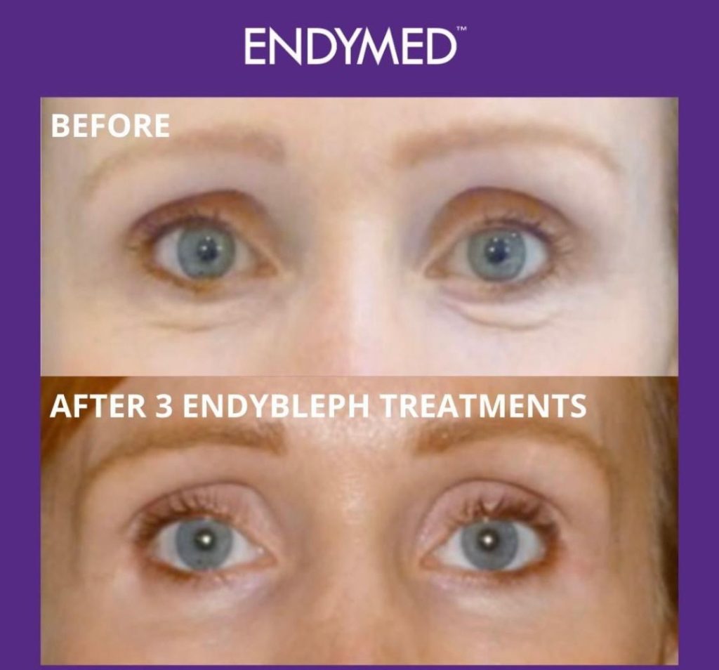 whatsapp image 2026 02 11 at 11.35.52