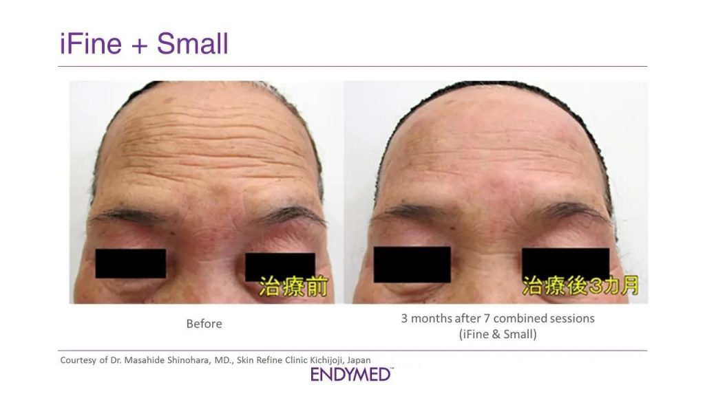 b9a16f20 0adb 4218 b0ab 277836a2fdfc