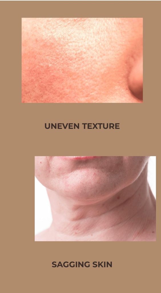 e341781f 2975 410b 89ac 43419c210d0c