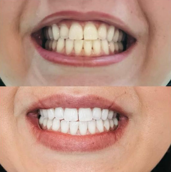 teeth